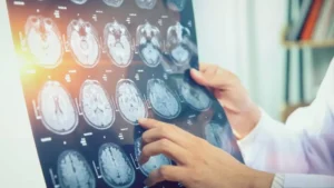 Imagem de diagnostico