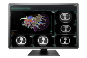 csm_RX660